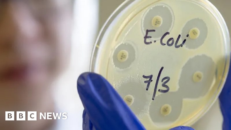 Person dies in UK E. coli outbreak linked to salad