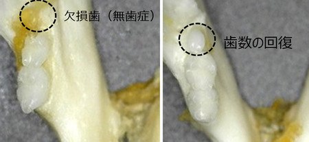 「歯生え薬」の治験開始へ＝３０年の実用化目指す―北野病院など