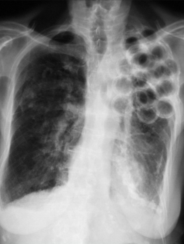 Sam Ghali, M.D. (@EM_RESUS)