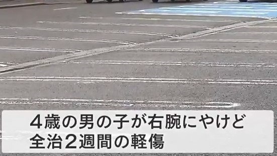 『突然やけど』４歳児の服から瞬間接着剤の成分検出「シアノアクリレート系樹脂」化学反応で100℃前後に発熱する可能性　大阪のだんじりパレード