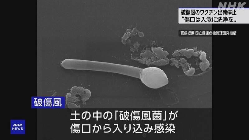 破傷風のワクチン 出荷停止 “けがの際 入念に洗浄を” 学会 | NHK