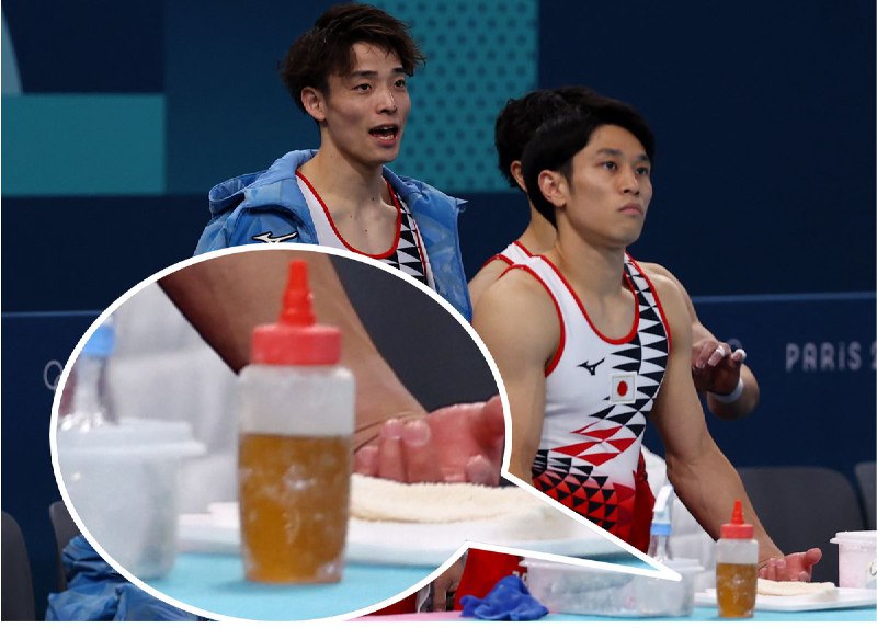 体操男子　滑り止めに“ハチミツ”？　平行棒で用いられる意外なアイテムの理由｜日テレNEWS NNN