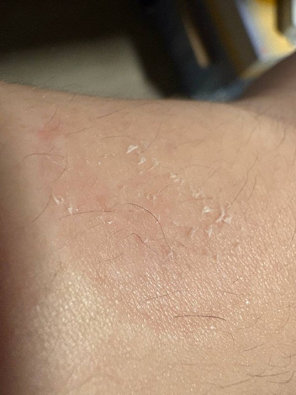 换苹果婊也没用