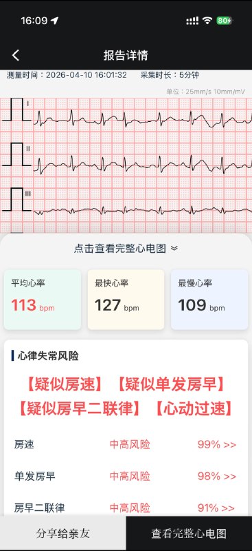 可以测 30s/1min/3min/5min3 min 及以上的测量周期会提供 HRV 指标和分析结果可以测 30s/1min/3min/5min3 min 及以上的测量周期会提供 HRV 指标和分析结果