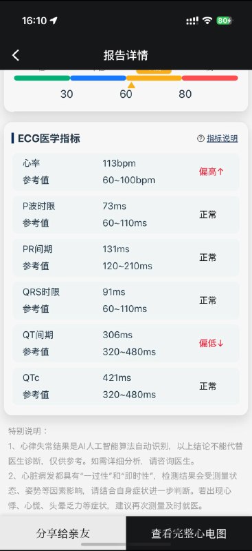 可以测 30s/1min/3min/5min3 min 及以上的测量周期会提供 HRV 指标和分析结果可以测 30s/1min/3min/5min3 min 及以上的测量周期会提供 HRV 指标和分析结果